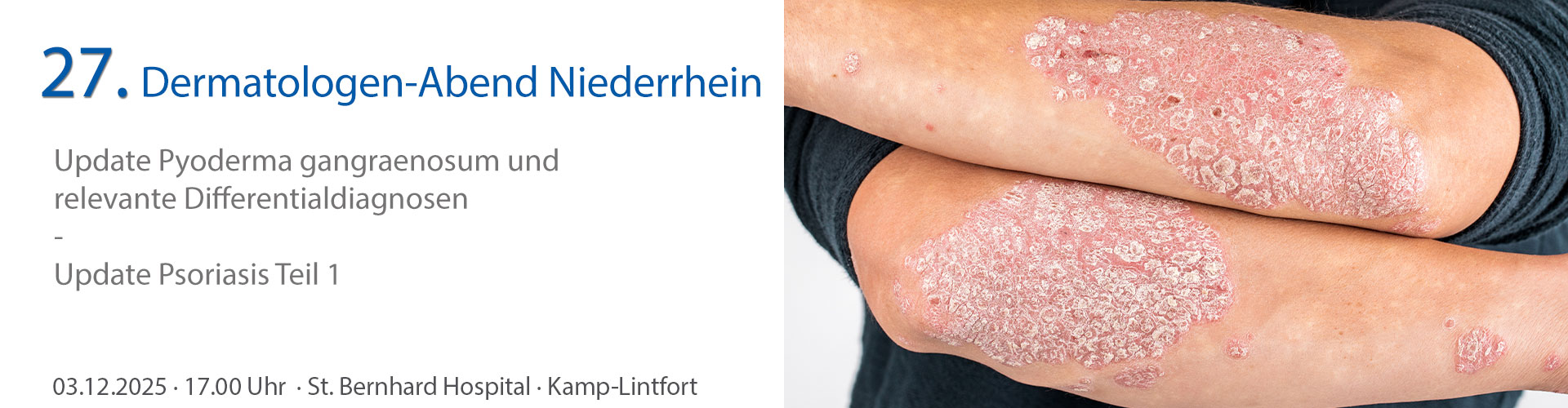 Dermatologische Fortbildunggesellschaft